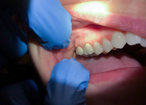 Best Broken Tooth Emergency  in Colonial Heights, VA